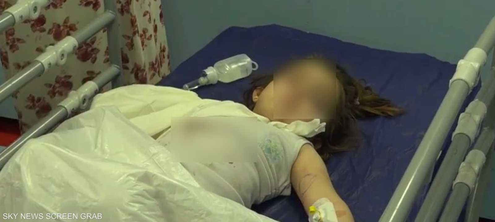 دب ينهش ذراع طفلة في حديقة حيوانات