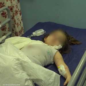 دب ينهش ذراع طفلة في حديقة حيوانات