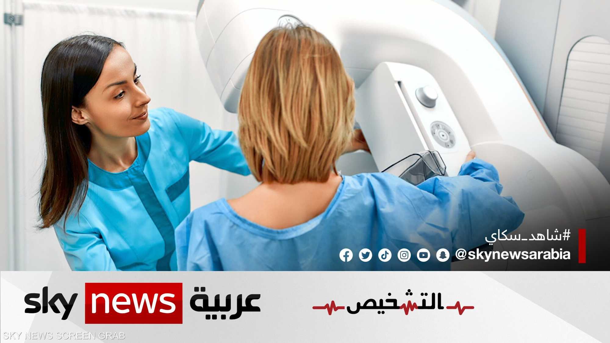 سرطان الثدي في المراحل الأولى