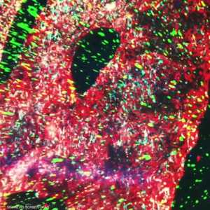 فحص Trucheck للدم يكشف عن 70 نوعا من السرطان