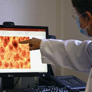 سرطان البنكرياس عدو خفي يتربص بصحة الإنسان