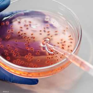 أرشيفية.. انتشار بكتيريا المكورات العنقودية "أي"