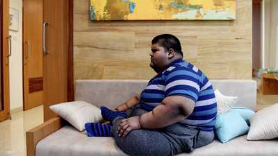 السمنة تزيد خطر الإصابة بـ 61 مرضا مهددا للحياة