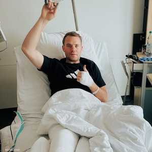 أصيب نوير بكسر في القسم السفلي من الساق