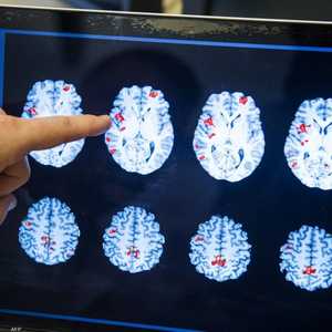 أرشيفية لصورة دماغ بشري
