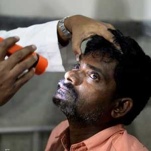 ما خطورة المياه البيضاء في العين؟