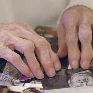 العقار معروف كيميائيا باسم ليكانماب