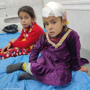 طفلتان من بين الأطفال المصابين جراء هجوم الكلاب الضالة.