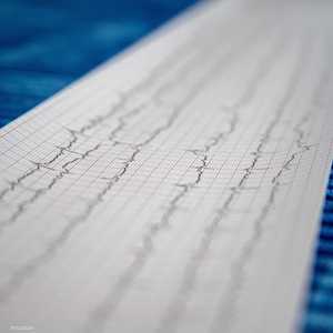 عارض يحذر النساء قبل وقوع النوبة القلبية