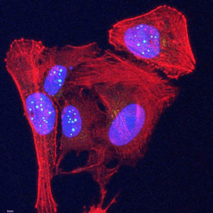 الاكتشاف يساعد على فهم أفضل لمرض السرطان
