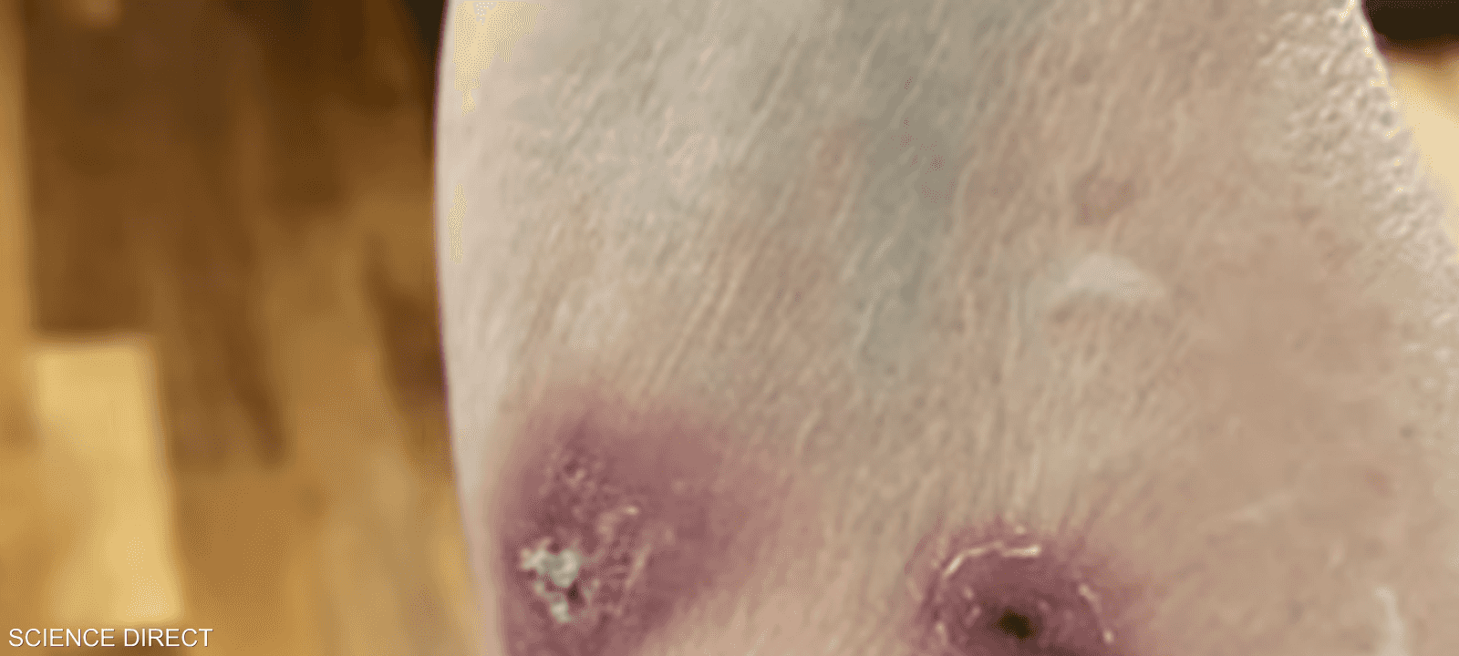 المرض الجلدي يوصف بالنادر