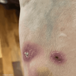 المرض الجلدي يوصف بالنادر