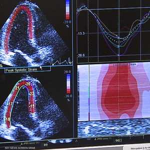 كيف يصوم مرضى الكوليسترول في رمضان؟