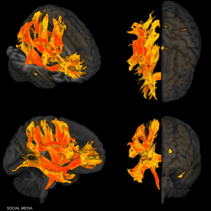 تعتبر بنية ووظيفة الدماغ معقدة للغاية