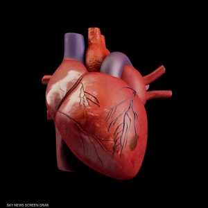 علاج رائد لعدم انتظام ضربات القلب بالإشعاع