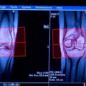 الصدفية.. سبل الوقاية والعلاج