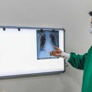 التدخين سبب رئيسي في سرطان الرئة وفق الأطباء