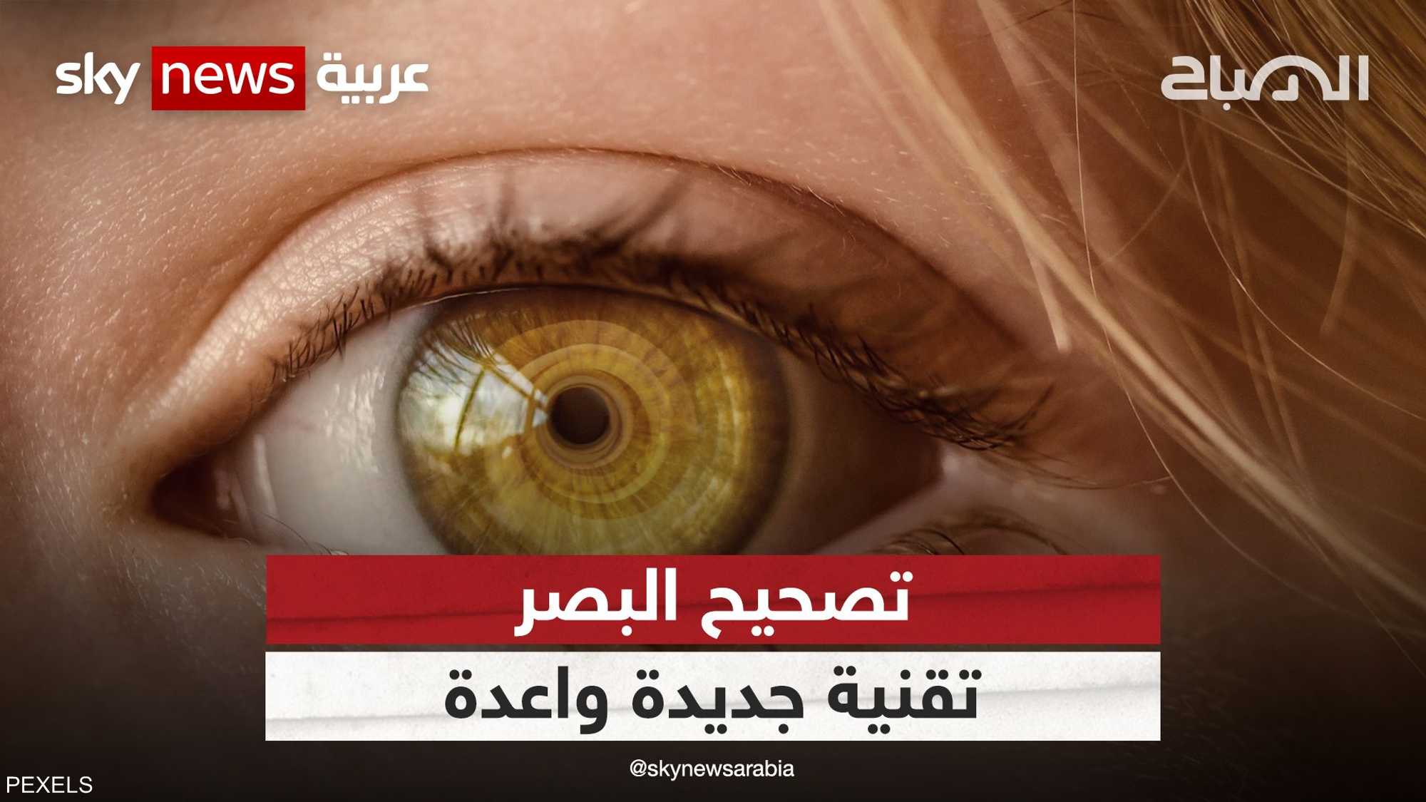 تصحيح البصر بالليزر المتطورة تساعد ملايين البشر