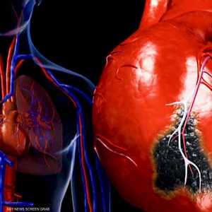 الجراحات طفيفة التوغل ابتكار يمهد لنجاح العمليات الدقيقة