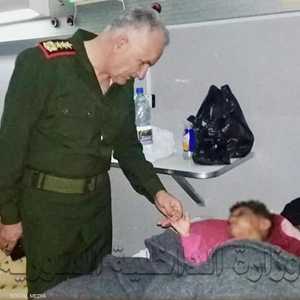 الطفلة جوري.. آثار ضربها تفطر قلوب السوريين