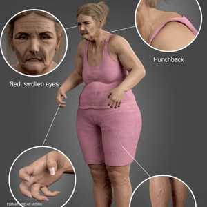 نموذج آنا الافتراضي