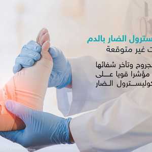 ماهي علامات الإصابة بارتفاع الكوليسترول الضار؟