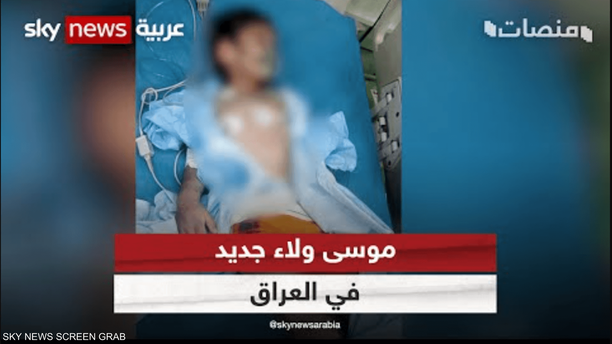 صور الطفل المعنف حيدر زيد تشعل موجة غضب ثانية