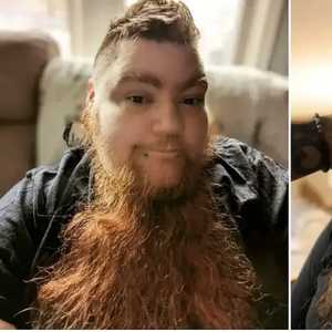 إيرين هونيكوت مصابة بمتلازمة تكيس المبايض