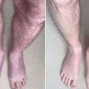 يؤثر "كوفيد 19" على أجهزة متعددة في الجسم