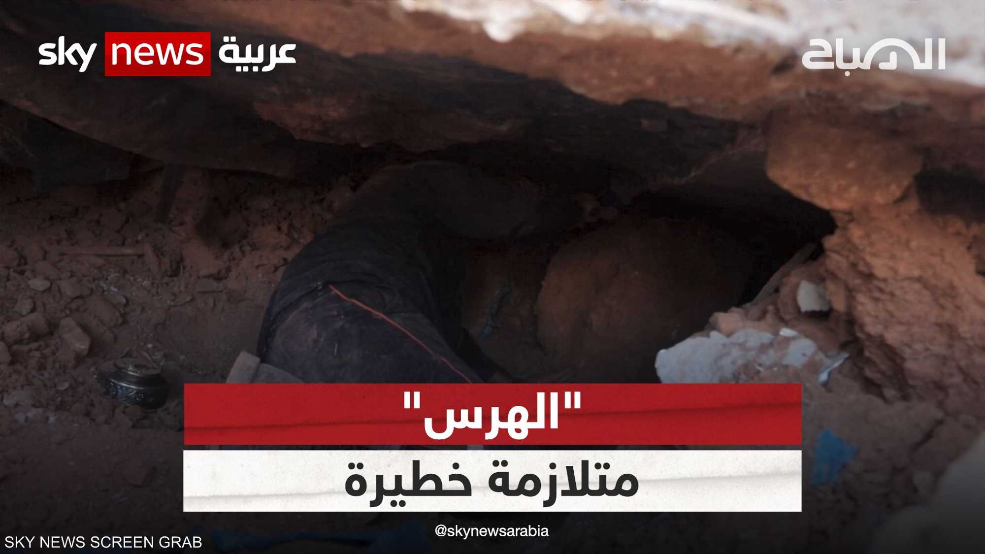 بعد الزلزال ماذا تعرفون عن "متلازمة الهرس" ؟.. طبيب يشرح