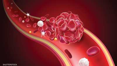سرطان الدم.. ما العلاج الأنجع للحالات المستعصية؟
