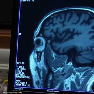 "لم يفت الأوان بعد".. شعار اليوم العالمي للتوعية بألزهايمر