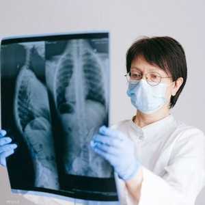 التصوير الشعاعي للصدر هو أداة تشخيصية شائعة