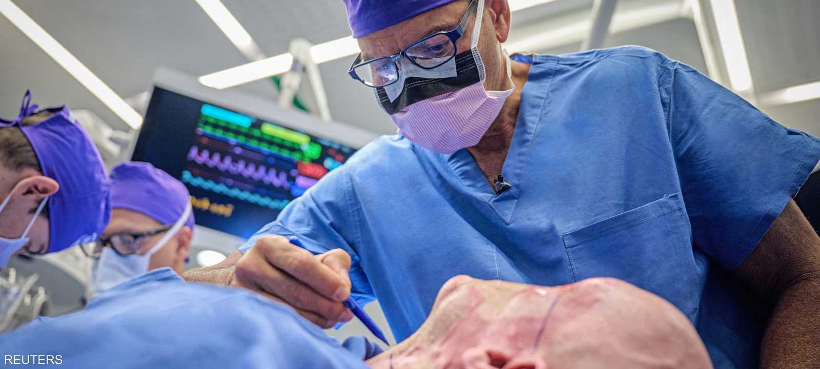 أول عملية على الإطلاق لزراعة عين كاملة لشخص