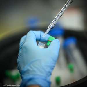 دراسة تؤكد على أهمية مكافحة السمنة والوقاية من السرطان