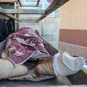 جثمان أحد ضحايا القصف الإسرائيلي أمام مشرحة مستشفى ناصر