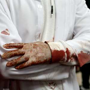 دماء قتلى فلسطينيين من مخيم الفارعة على كُمي أحد الأطباء