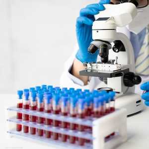 اختبار الدم الجديد يبحث عن أجزاء من الحمض النووي للسرطان