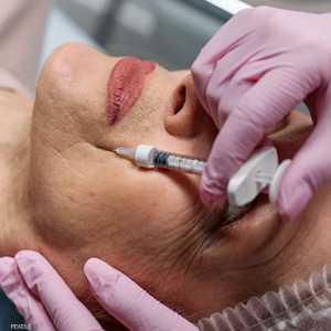 النساء الشابات الأصحاء لديهن بكتيريا أقل تنوعا على وجوههن