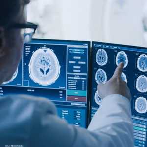 اختبار دم يمكن استخدامه للكشف عن أنواع من سرطانات الدماغ