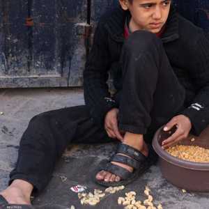 حسرة على وجه طفل اندلق ماعون "التكيات" الساخن على قدمه