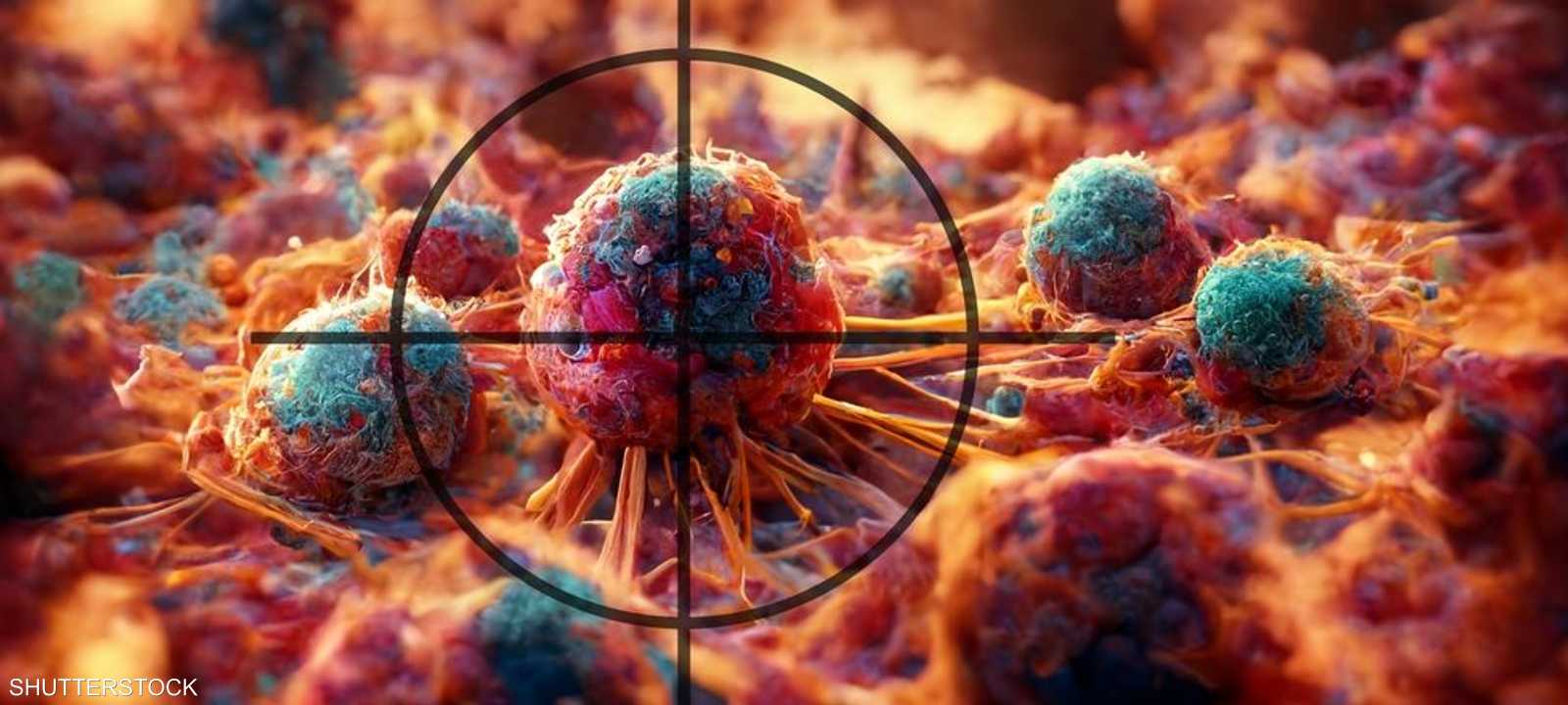 العقار الجديد يستهدف الخلايا السرطانية.. أرشيفية