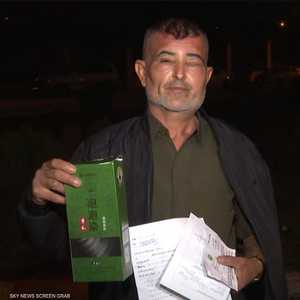 رجل تعرض لتورمات وحروق شديدة بسبب الشامبو