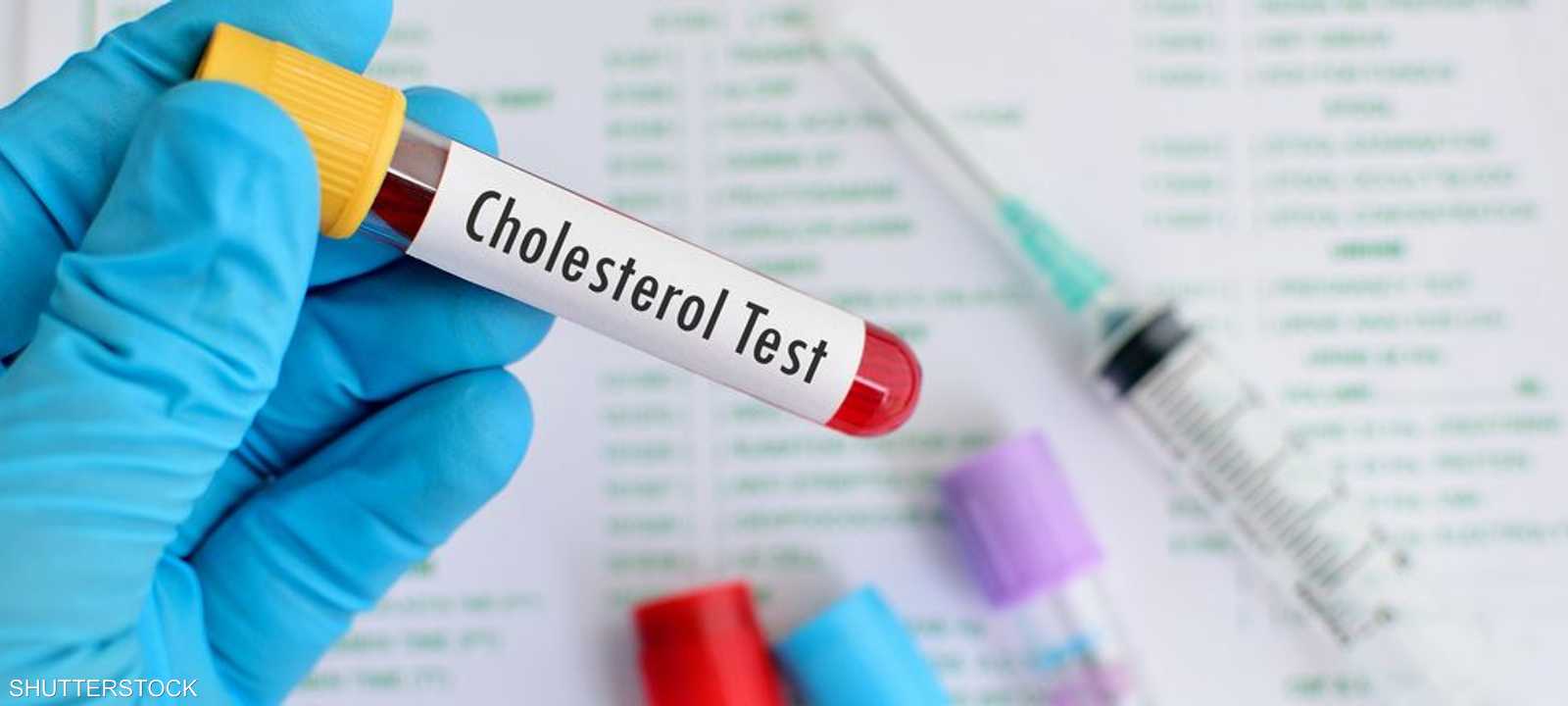 أرشيفية لاختبار نسبة الكوليسترول في الدم