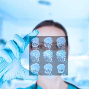 حثل المادة البيضاء متبدل اللون هو اضطراب وراثي نادر.أرشيف