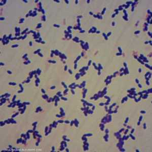 البكتيريا العقدية يمكن أن تكون قاتلة