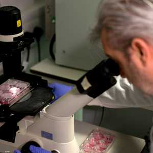 أرشيفية.. العلماء يعتقدون أن الاختبار سيكشف المرض مبكرا