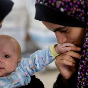 تم نقل الطفل من مستشفى كمال عدوان إلى المستشفى الإماراتي