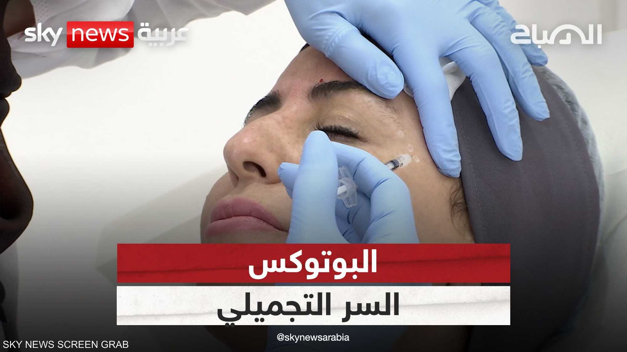 البوتوكس أشهر الإجراءات التجميلية وأكثرها شيوعا