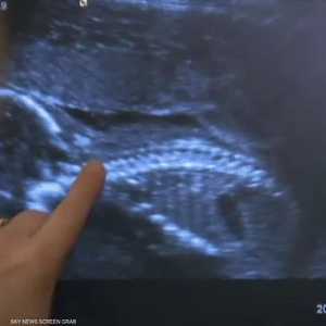 أدمغة الرجال تتغير أيضا عندما يصبحون آباءً